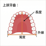 Mewsurement of dental arch width